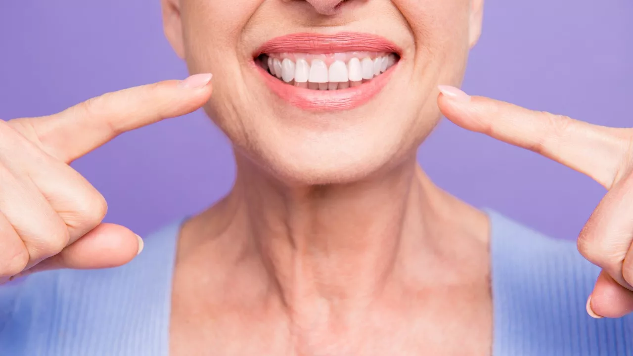 Puuttuva hammas voi vetää mielen matalaksi. Kuvassa nainen hymyilee niin, että koko hammasrivi näkyy.