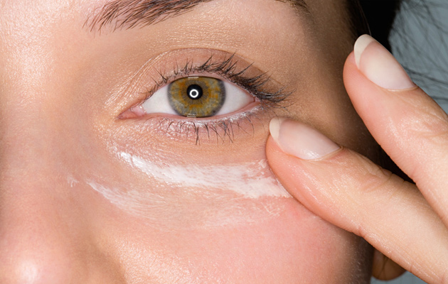 Silmäpussit ovat yleensä kosmeettinen vaiva, joka ei haittaa terveyttä.