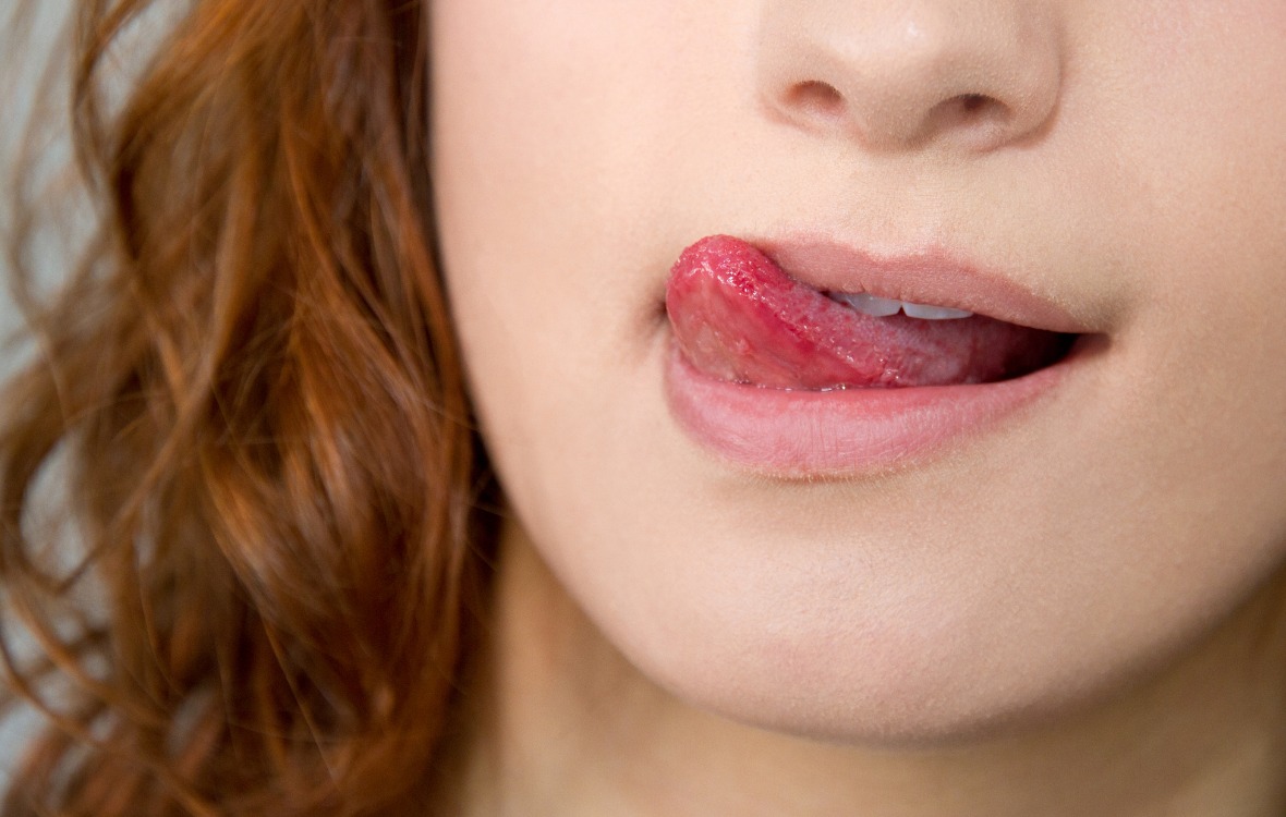 Kuivat huulet voivat johtua huulten nuolemisesta, sillä sylki kuivattaa ihoa.