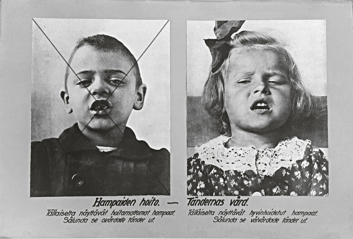 Lapsille tarkoitetussa opastaulussa esitellään hoidettuja ja rikkinäisiä hampaita.
